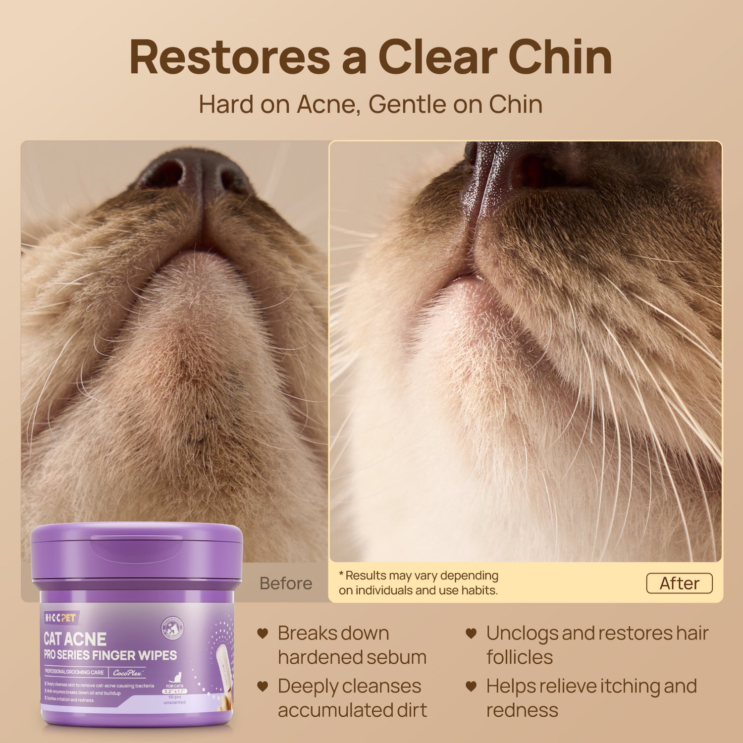 Cat Chin Acne Cleansing & Care Kit